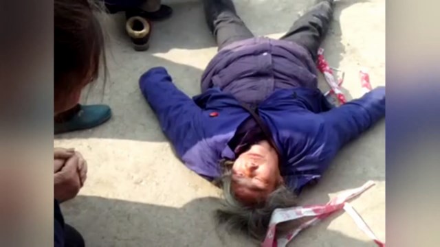 一信徒被嚴重打傷 一信徒被嚴重打傷